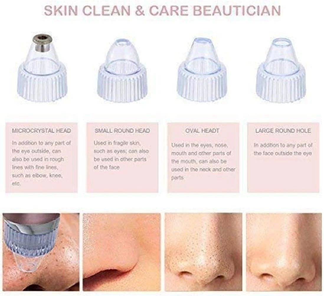 Pore Vacuum Cleaner | جهاز تنظيف المسام وإزالة الرؤوس السوداء