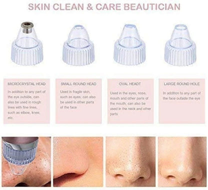 Pore Vacuum Cleaner | جهاز تنظيف المسام وإزالة الرؤوس السوداء