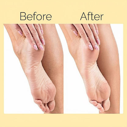 Electric Foot Callus Remover | جهاز إزالة الجلد الميت للقدم